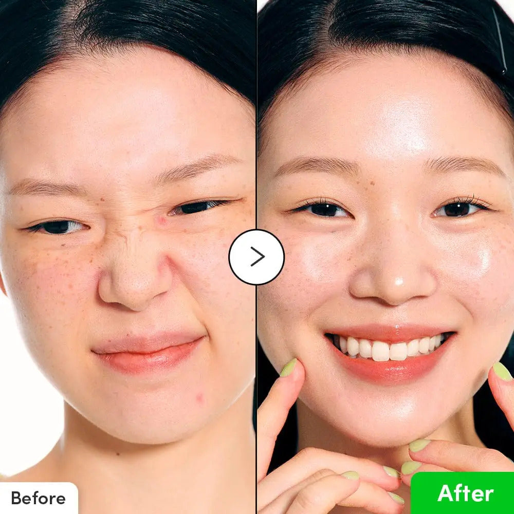 EQQUAL BERRY GREEN AID ALOE PDRN CALMING SERUM – Sérum Apaisant & Régénérant